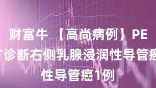 财富牛 【高尚病例】PET/CT诊断右侧乳腺浸润性导管癌1例